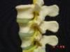 Model of lumbar spine